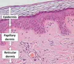 Histology section showing the epidermis sitting atop the papillary dermis (finger-like projections interlocking with the epidermal underside) and the deeper, denser reticular dermis.