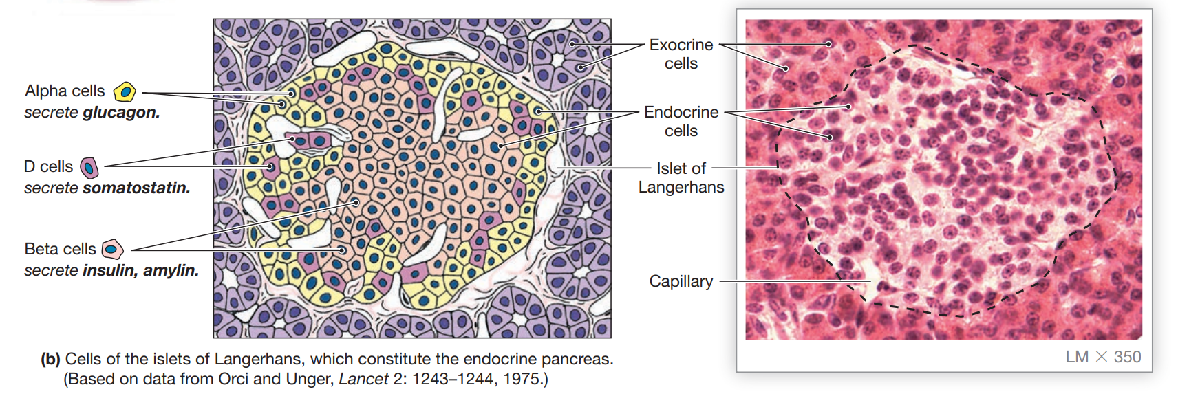 Pancreatic tissue showing exocrine acini surrounding an islet of Langerhans, with alpha cells (glucagon), beta cells (insulin/amylin), and D cells (somatostatin) identified, alongside a real histology micrograph of an islet outlined among the surrounding exocrine tissue.