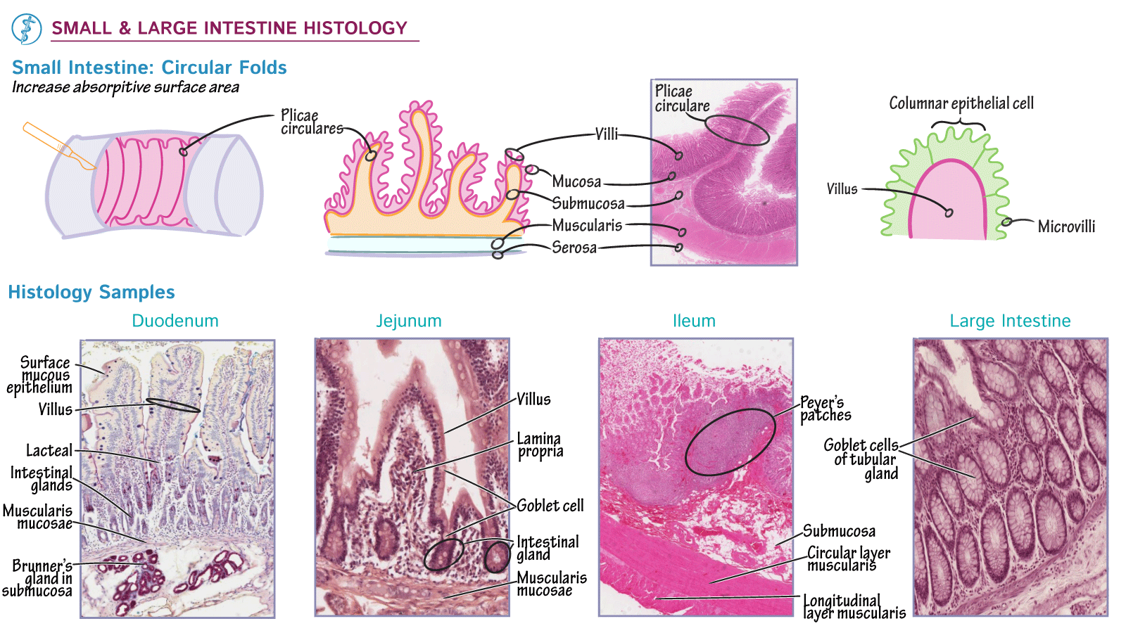 Small/large intestine histology: the plicae circulares→villi→microvilli surface-amplification hierarchy, then four real histology samples side by side — duodenum (with Brunner’s glands visible in the submucosa), jejunum (villi, lamina propria, goblet cells), ileum (a Peyer’s patch clearly circled), and large intestine (goblet cells of the tubular gland, no villi).