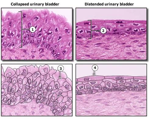 Transitional epithelium histology compared between a collapsed (relaxed) and a distended (stretched) urinary bladder wall, each shown as both a real micrograph and a labeled line diagram — cell layers appear taller/more numerous when collapsed and flattened/fewer when stretched.