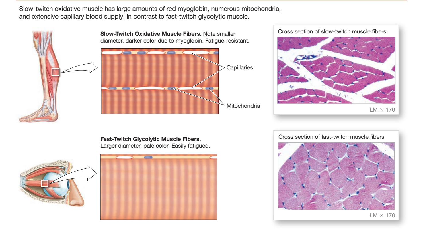 Slow-twitch oxidative fibers (smaller diameter, darker red from myoglobin, numerous mitochondria and capillaries, fatigue-resistant, shown in a calf muscle) compared to fast-twitch glycolytic fibers (larger diameter, pale color, easily fatigued, shown in an eye muscle), each paired with an actual light-micrograph cross-section of that fiber type