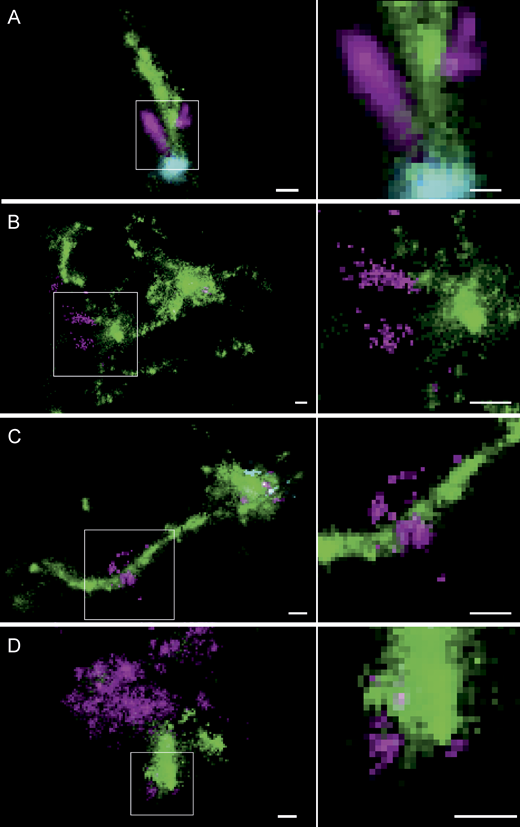 Four stacked rows, A to D, of dark microscope images. Each row has a wide view of green cell material with small magenta speckles and a boxed region enlarged on the right, with scale bars.