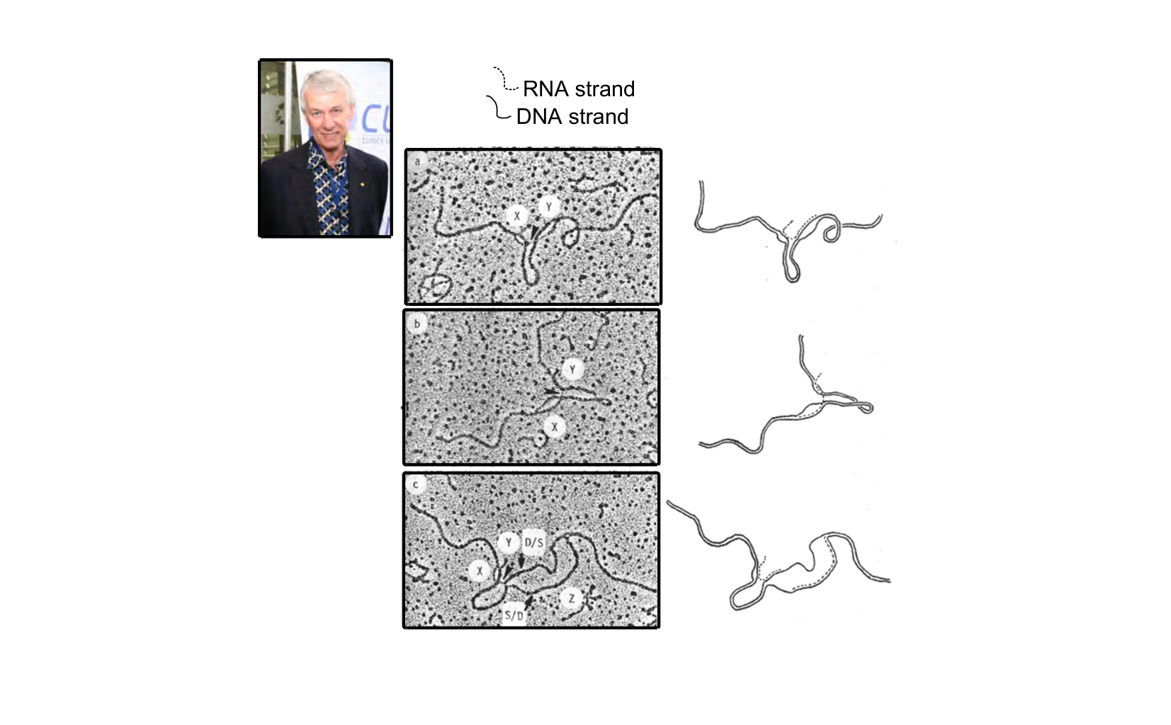 Figure for Q9: Reading Adenovirus Transcription/Splicing from EM Images
