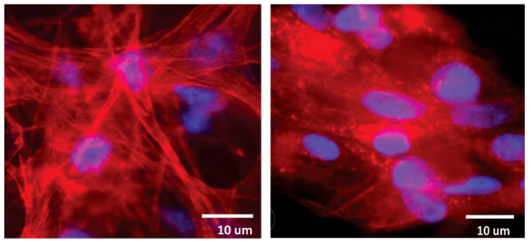 Figure 2. Confocal images of fibroblast (left) and myocyte (right) laden constructs, showing red and blue staining.