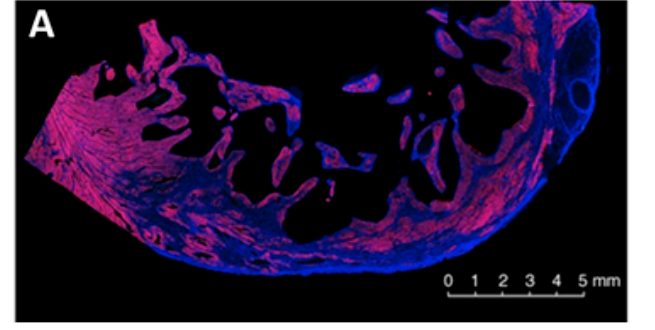 Figure 1. Cross-sections of the ventricular wall of an infarcted heart from a sham-treated monkey.