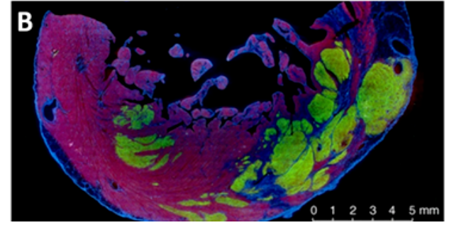 Figure 2. Cross-sections of the ventricular wall of an infarcted monkey heart with grafts of hESC-derived cardiac myocytes, GFP-labelled.