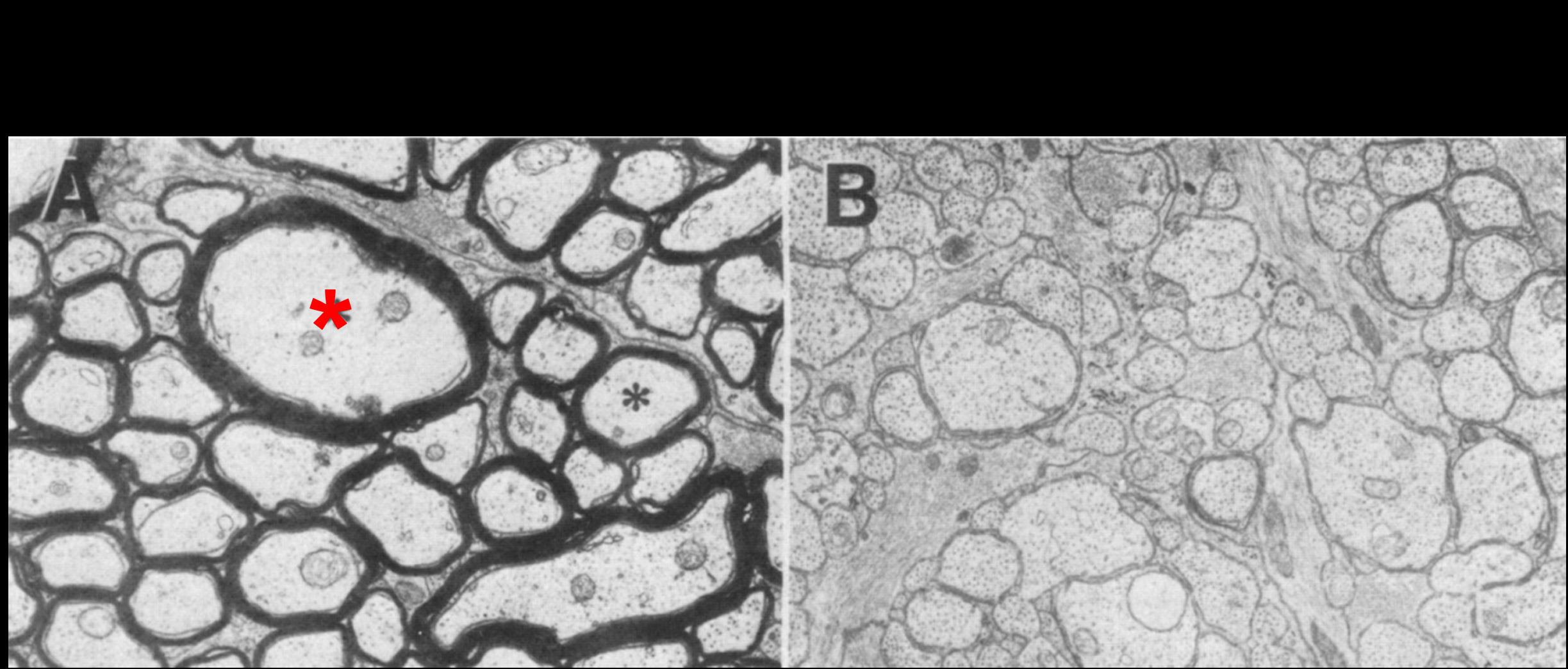 Cross-sections of wild-type (A) and shiverer-mutant (B) optic nerve, stained for lipids.