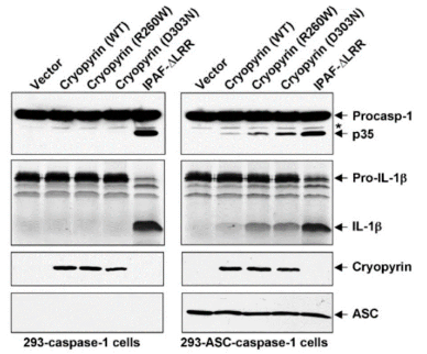 Figure. Western blot results for each cell line: (1) empty vector, (2) vector with WT cryopyrin, (3) vector with the cryopyrin R260W mutant, (4) vector with the cryopyrin D303N mutant, (5) vector with IPAF-ΔLRR, which causes autocleavage of procaspase-1 independent from all other factors. Rows show Procasp-1/p35, Pro-IL-1β/IL-1β, Cryopyrin, and ASC.