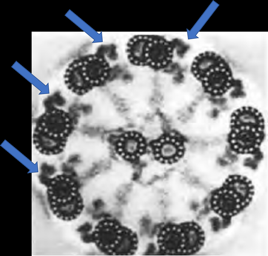 Diagram showing the dynein arm molecular complex on cilia, with blue arrows indicating the affected component