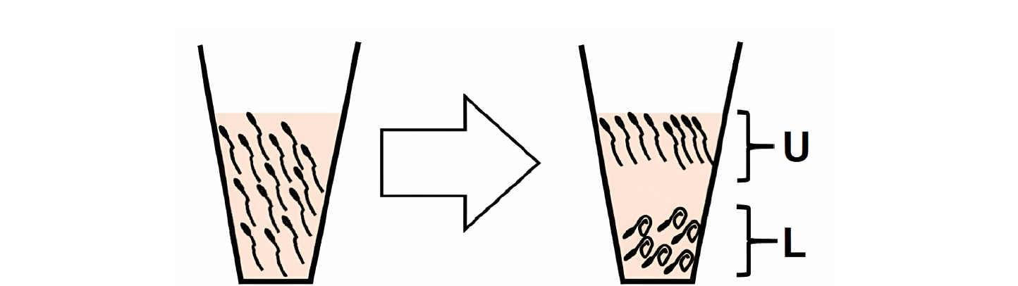 Diagram of the swim-up method used to sort sperm by motility, separating an upper layer (U) of highly motile sperm from a lower layer (L) that remains in the seminal plasma.